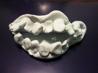 My son needed a tooth extracted so we made our own mouth and teeth to demonstrate what would happen and practice coping skills